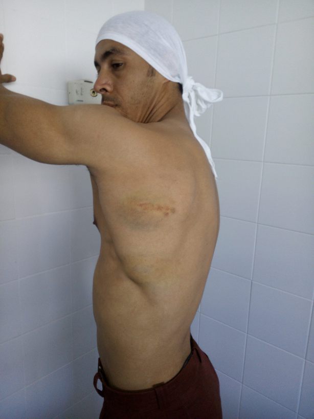 imagen-marca-de-gresiones